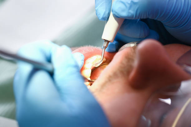 Best Tooth Pain Emergency Relief  in Kootenai, ID