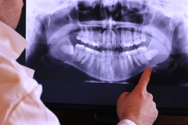 Best Broken Tooth Emergency  in Kootenai, ID