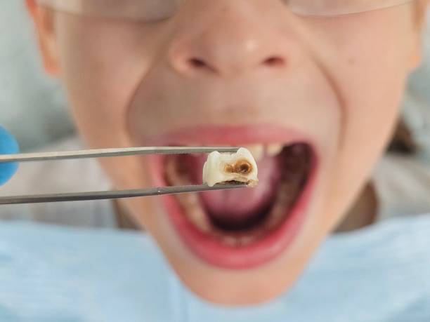 Best Emergency Pediatric Dentist  in Kootenai, ID